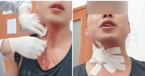 Khó tin: Nhập viện do vỡ tĩnh mạch sau khi cố đập… muỗi缩略图