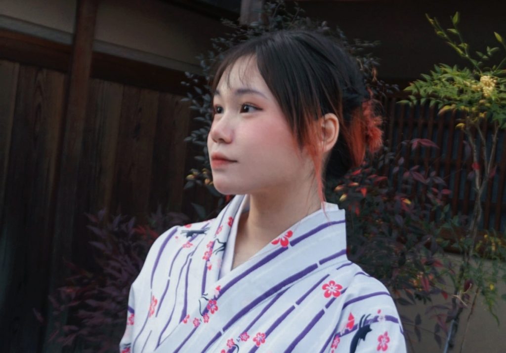 Cô gái mất một chân vì ung thư, từng chui vào tủ để tránh ánh nhìn người khác缩略图 Cô gái mất một chân vì ung thư, từng chui vào tủ để tránh ánh nhìn người khác缩略图