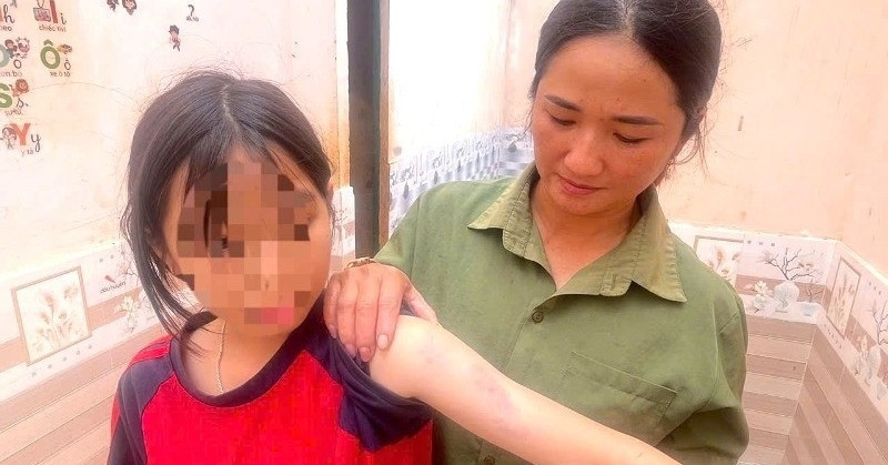 Người dân kể phút lốc xoáy cuốn qua: 'Gió rít mạnh, các con tôi hoảng loạn bỏ chạy'缩略图 Người dân kể phút lốc xoáy cuốn qua: 'Gió rít mạnh, các con tôi hoảng loạn bỏ chạy'缩略图