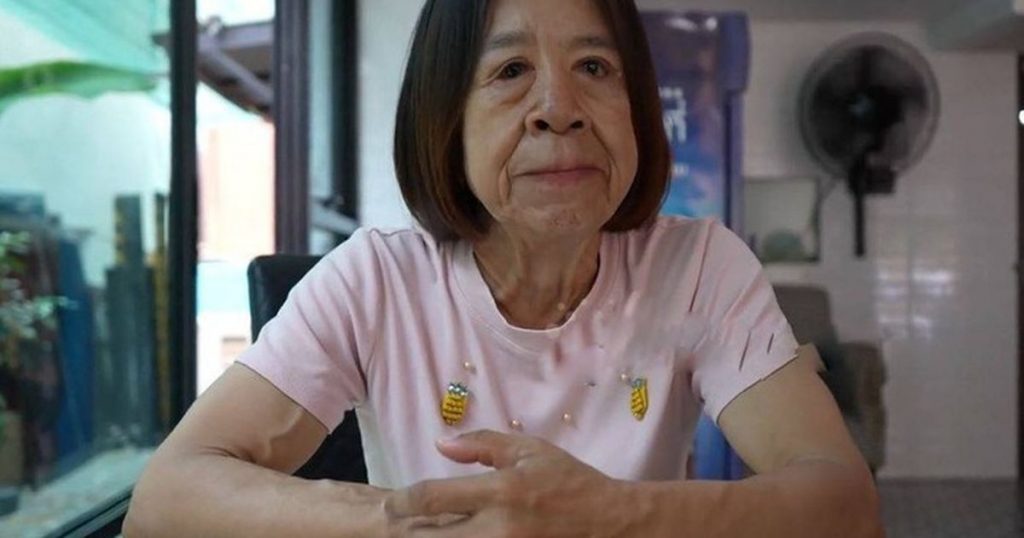 Suốt nhiều năm bị dị nghị do mắc hội chứng hiếm gặp, cô gái 29 tuổi hy vọng 'đổi đời' ca phẫu thuật thay đổi diện mạo缩略图 Suốt nhiều năm bị dị nghị do mắc hội chứng hiếm gặp, cô gái 29 tuổi hy vọng 'đổi đời' ca phẫu thuật thay đổi diện mạo缩略图