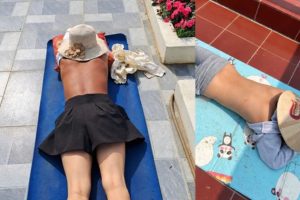 Cảnh báo nguy cơ sức khỏe từ trào lưu &amp;apos;phơi nắng giữa trưa&amp;apos;缩略图